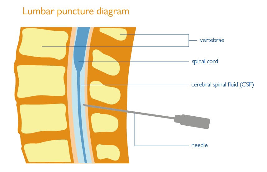 Lumbar Puncture Spine Anatomy